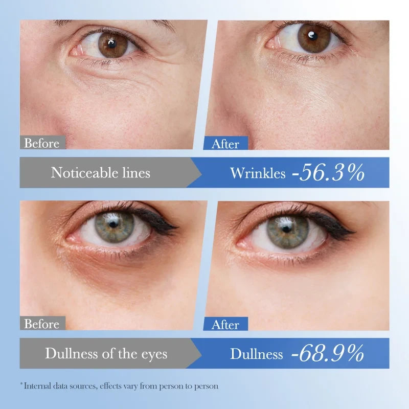 CAVIAR LUXE EYE RENEWAL CREAM FOR WOMEN